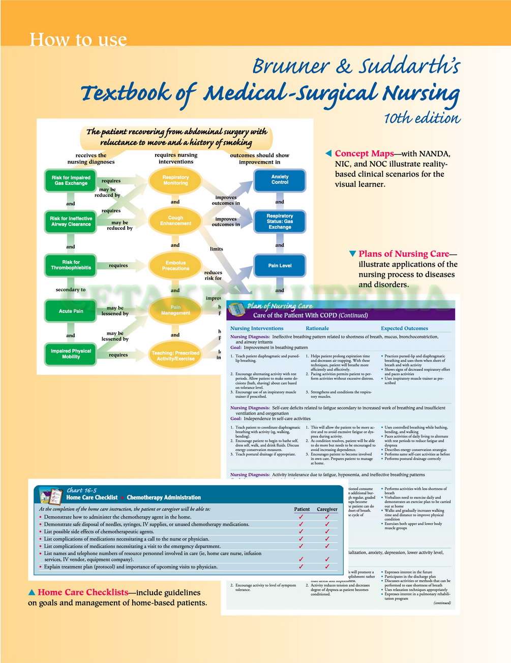 Medical Surgical Nursing 10th Edition by Brunner & Suddarth - Cetakebook.com